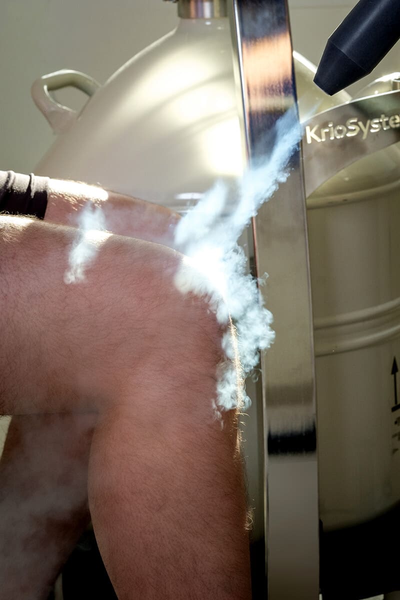 Krioterapia