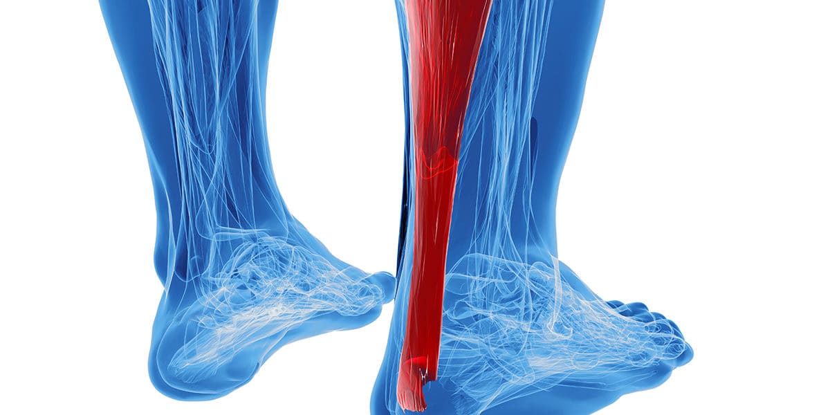 ból łydki svg+xml,%3Csvg%20xmlns%3D'http%3A%2F%2Fwww.w3